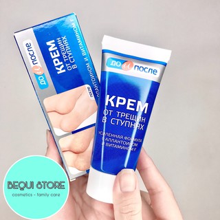 Kem nứt gót chân kpem nga