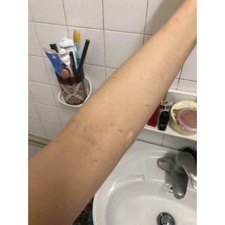 💚COMBO 2 MIẾNG KÌ GHÉT CỰC ĐÃ