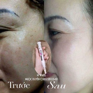 Mặt nạ ngủ - MWHITE