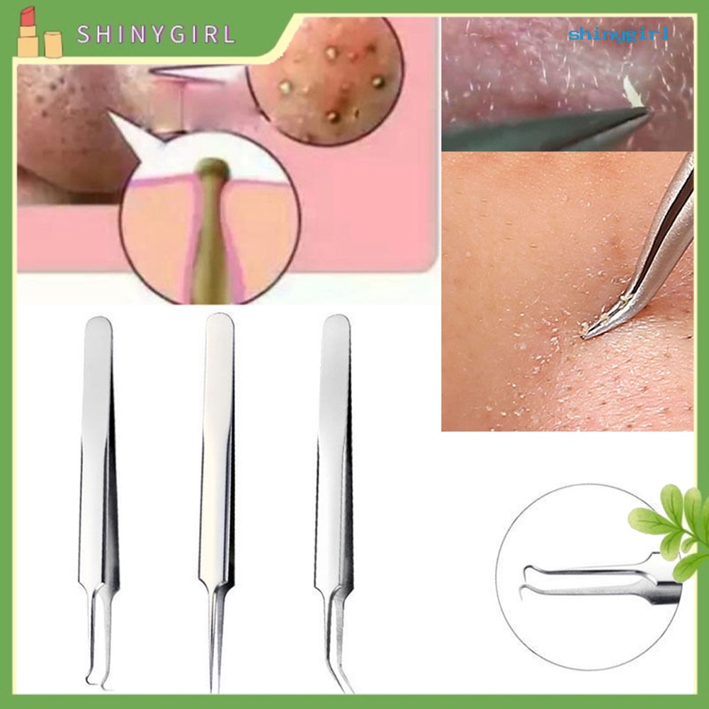 Nhíp Lấy Nhân Mụn Đầu Đen Tiện Lợi