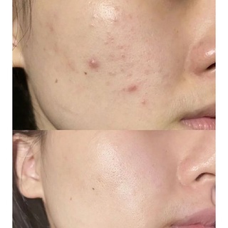 Toner SVR Sebiaclear Micropeel 150ml