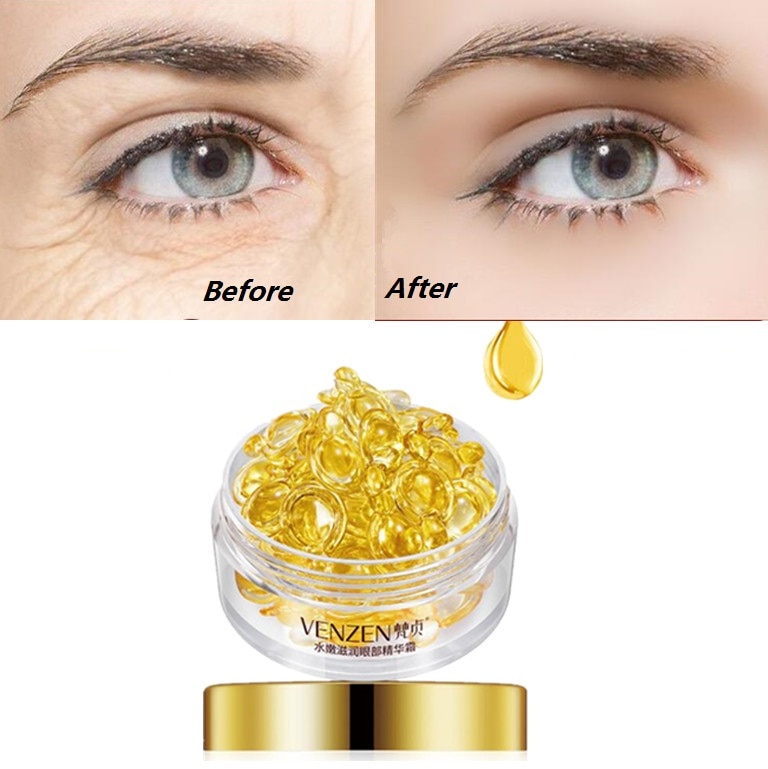 Viên Nang Venzen Dẫn Xuất Từ Axit Hyaluronic Chứa Tinh Chất Dưỡng Da Mắt Loại Bỏ Nếp Nhăn Một Cách Hiệu Quả 30g