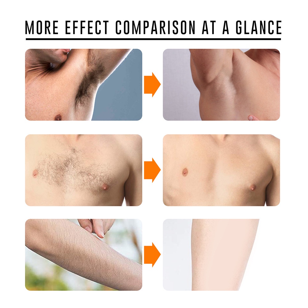 Kem tẩy lông vùng da dưới cánh tay cho nam nữ | BigBuy360 - bigbuy360.vn