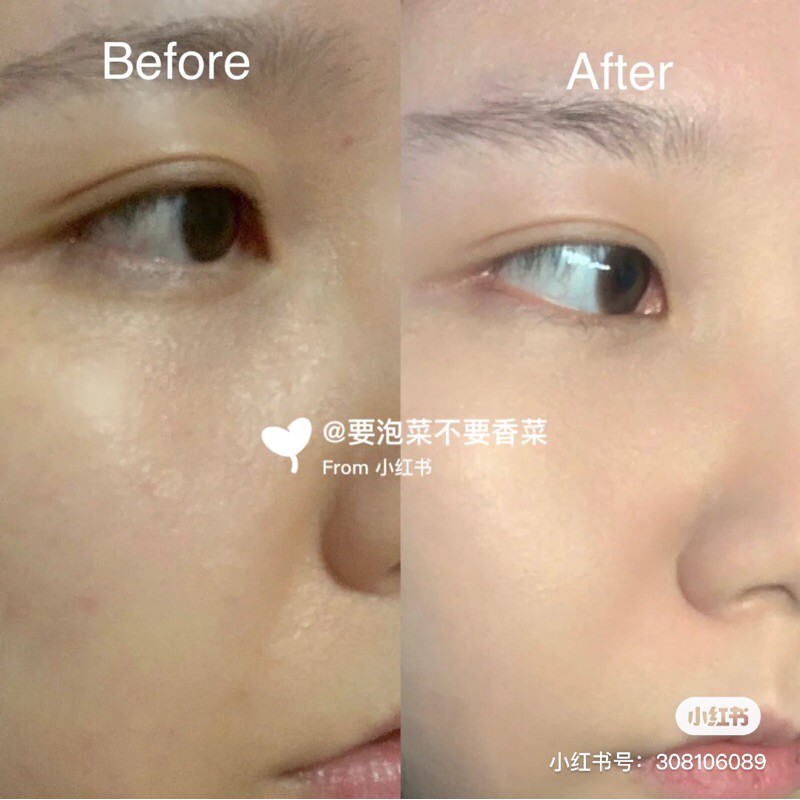 Kem ngọc trai trắng da Medipeel Blue Aqua Tox