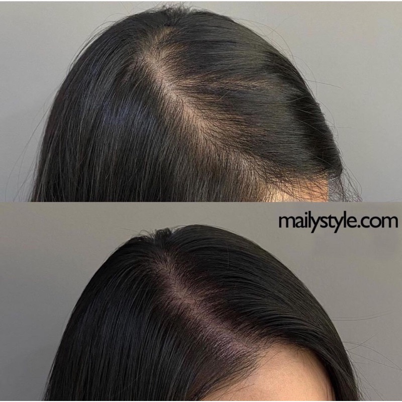 VIÊN UỐNG MỌC TÓC BIOTIN CỦA SAMSUNG FHARM - Biotin Nutri Day