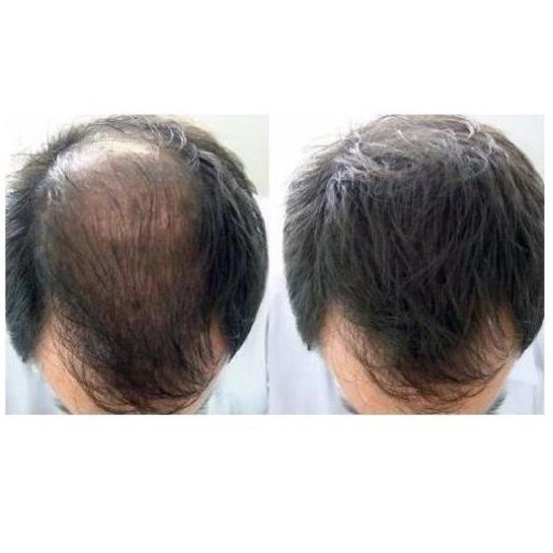 DHQG dài mi mọc tóc 10gr