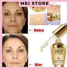 SERUM 24K GOLD Tinh chất dưỡng da chuyên sâu trắng da và chống lão hóa Bioaqua