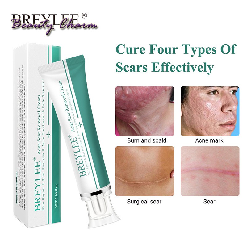 [Hàng mới về] Kem Hỗ Trợ Giảm sẹo 30ml chuyên dụng | BigBuy360 - bigbuy360.vn