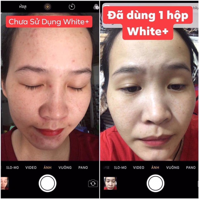 Viên uống trắng da, mờ nám, trị mụn white+++ | BigBuy360 - bigbuy360.vn
