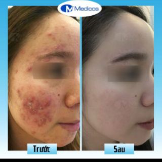 Sữa rửa mặt Medicos Deep Cleanser