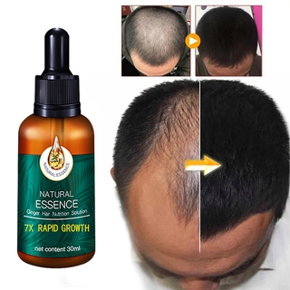 [Hàng mới về] Tinh Dầu Gừng 30ml Kích Thích Mọc Tóc Chống Rụng Hiệu Quả