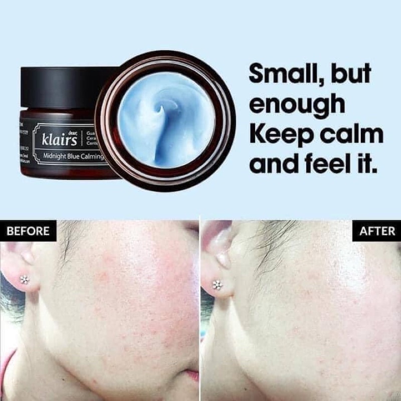 Kem dưỡng Klairs Midnight Blue Calming Cream 30ml & 60ml
