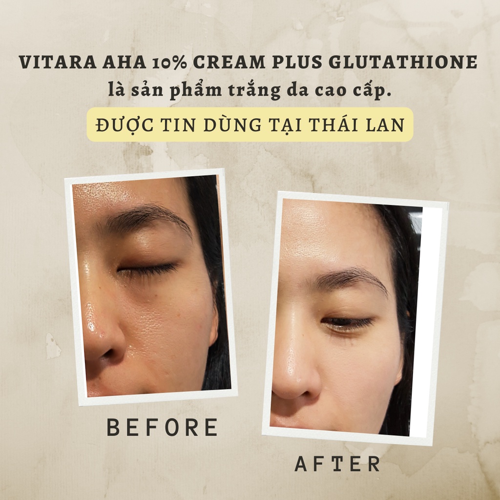 Kem trắng da Vitara AHA 10% Cream Extra Plus cho da không đều màu có Glutathoinegiúp da trắng sáng, mềm mịn hơn 20g