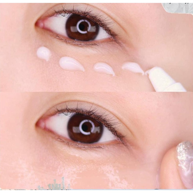 KEM DƯỠNG MẮT KUMARGIC | BigBuy360 - bigbuy360.vn