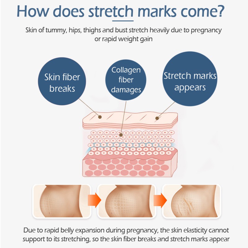 Kem Hỗ Trợ Giảm Sẹo Sau Khi Sinh VIBRANT GLAMOUR Làm Trắng Và Săn Chắc Mịn Mượt Chống Lão Hóa 30g | BigBuy360 - bigbuy360.vn