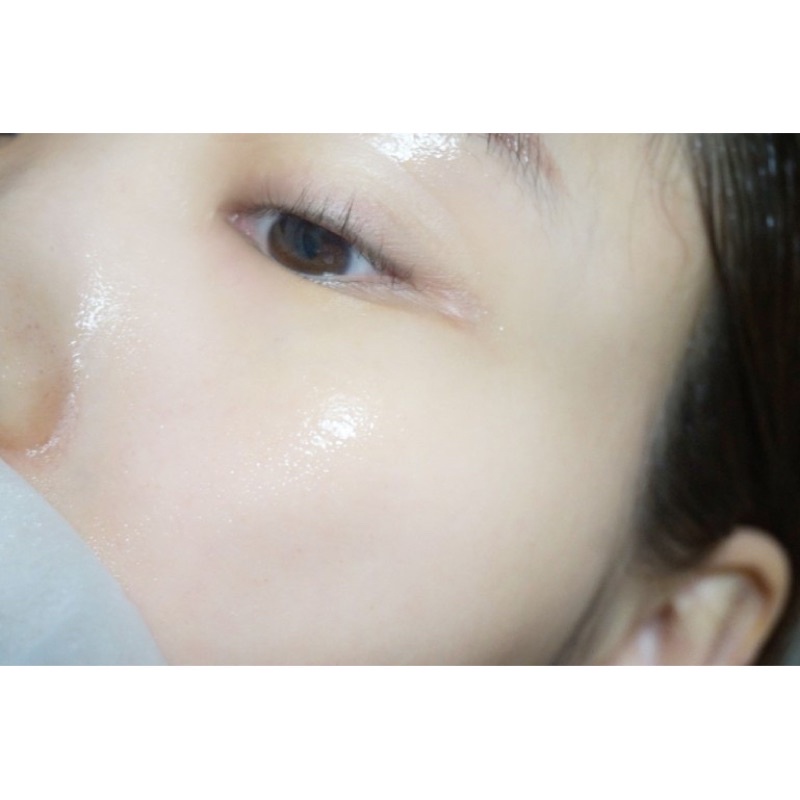 Serum diếp cá hỗ trợ da mụn EDLP Houttuynia cordata 89% Serum Eoseongcho 89% Serum