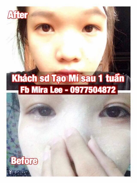 Tinh Chất Tạo Mắt 2 Mí Miracle