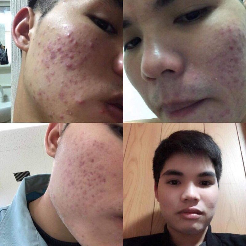 SÊ RUM THẢO DƯỢC TÁI TẠO DA NLS | BigBuy360 - bigbuy360.vn