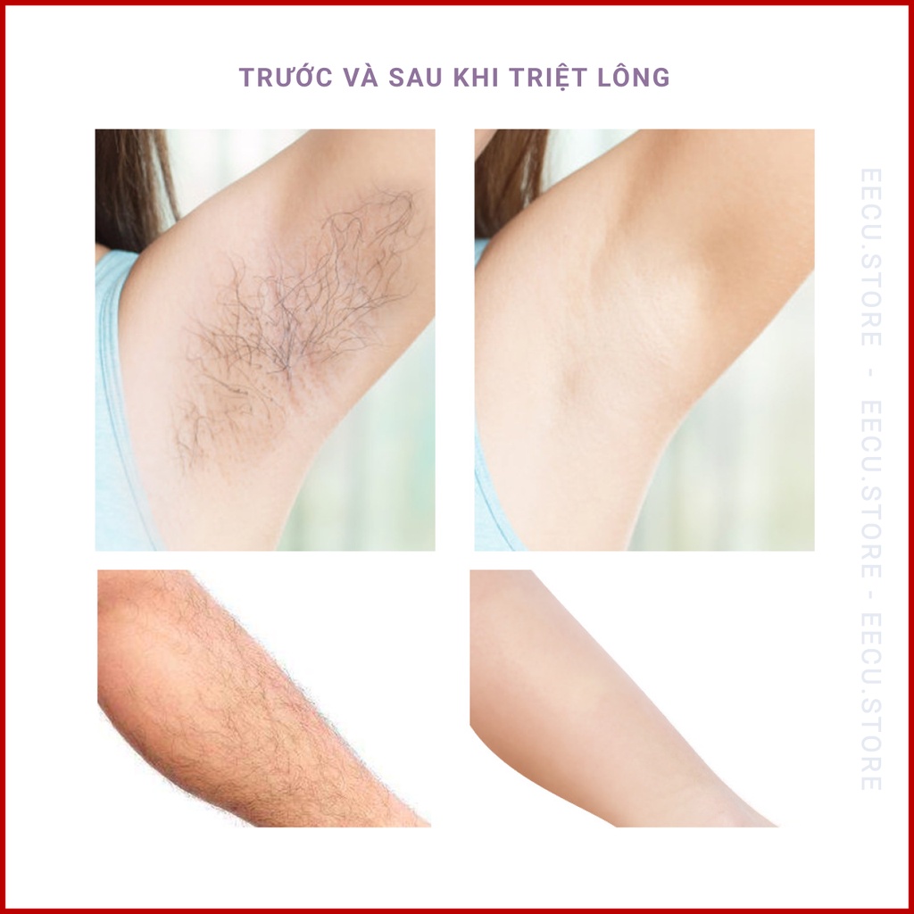 [ Cao Cấp ] Máy Triệt Lông Tại Nhà Công Nghệ IPL Chính Hãng Cá Nhân Mini Cầm Tay, Máy Tẩy Lông, Triệt Lông Vĩnh Viễn