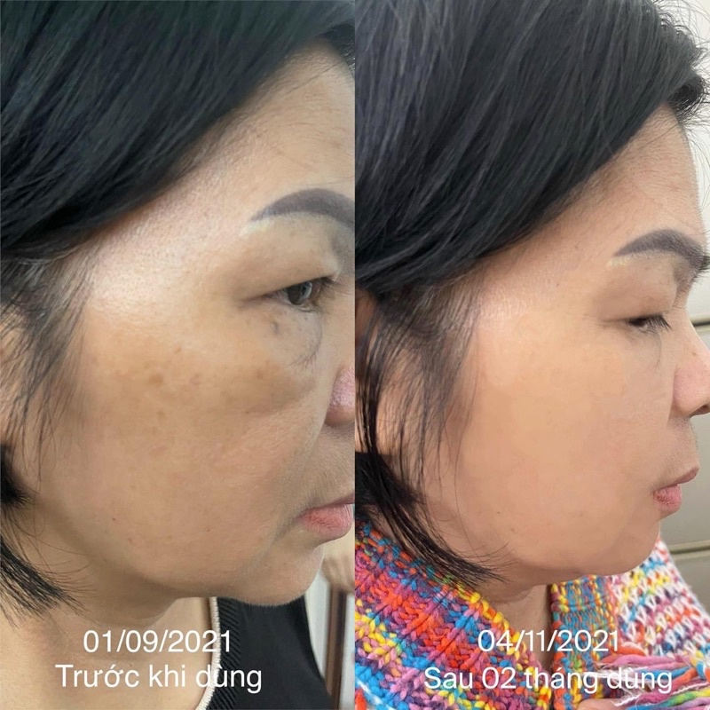 Kẹo Ngậm Trắng Da - Hủy Nám 6S Shining Pearl Chuẩn Nội Địa Hàn Quốc.