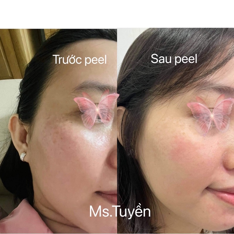 vi tảo sinh học set lẻ | BigBuy360 - bigbuy360.vn