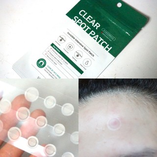 Miếng Dán Mụn Some By Mi Clear Spot Patch