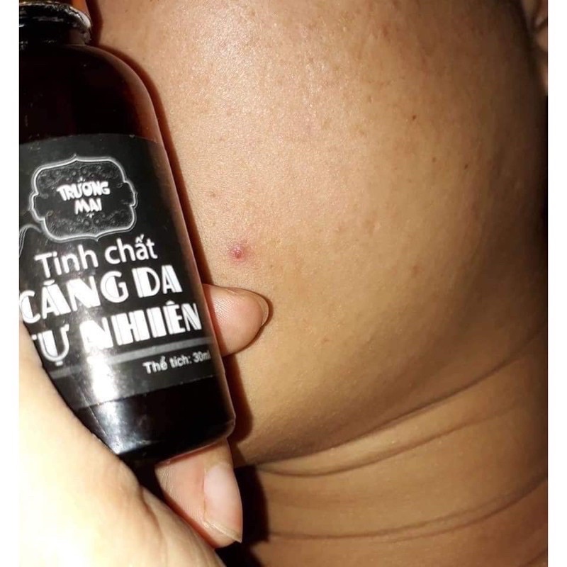 Cấy trắng bạch mộc trương mai bộ 4 món