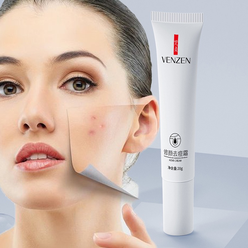 VEZE Kem giảm thâm mụn,liền sẹo, nam, nữ,ngăn ngừa mụn,giảm dầu,mau lành vết thương 20g