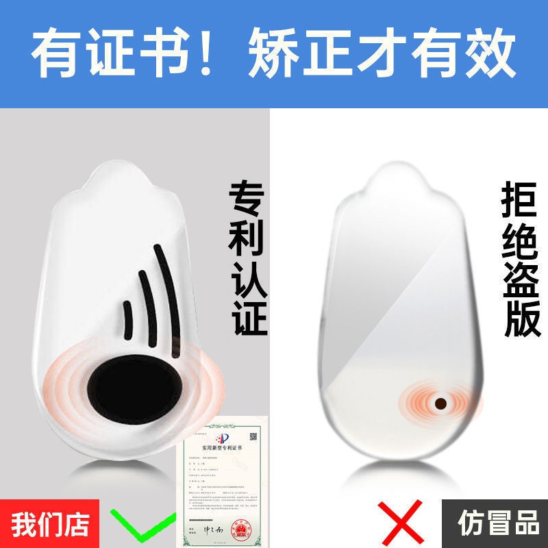 Dụng Cụ Chỉnh Hình Chân Kiểu Chữ O Và Thẳng Tám Khớp Ngón Chân Từ Tính Kiểu Chữ O