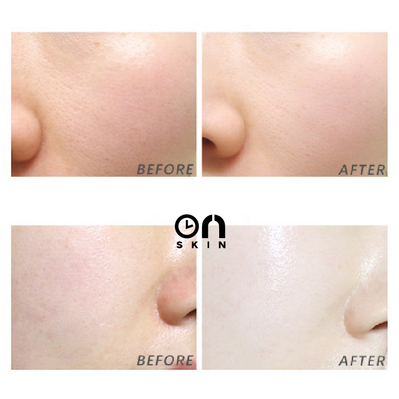 Laneige (hàng Mới Về) Bộ Mặt Nạ Ngủ Cho Môi + Mặt Nạ Ngủ Dưỡng Ẩm Tiện Dụng Khi Đi Du Lịch | BigBuy360 - bigbuy360.vn