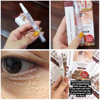 Mụn thịt Nhật Bản