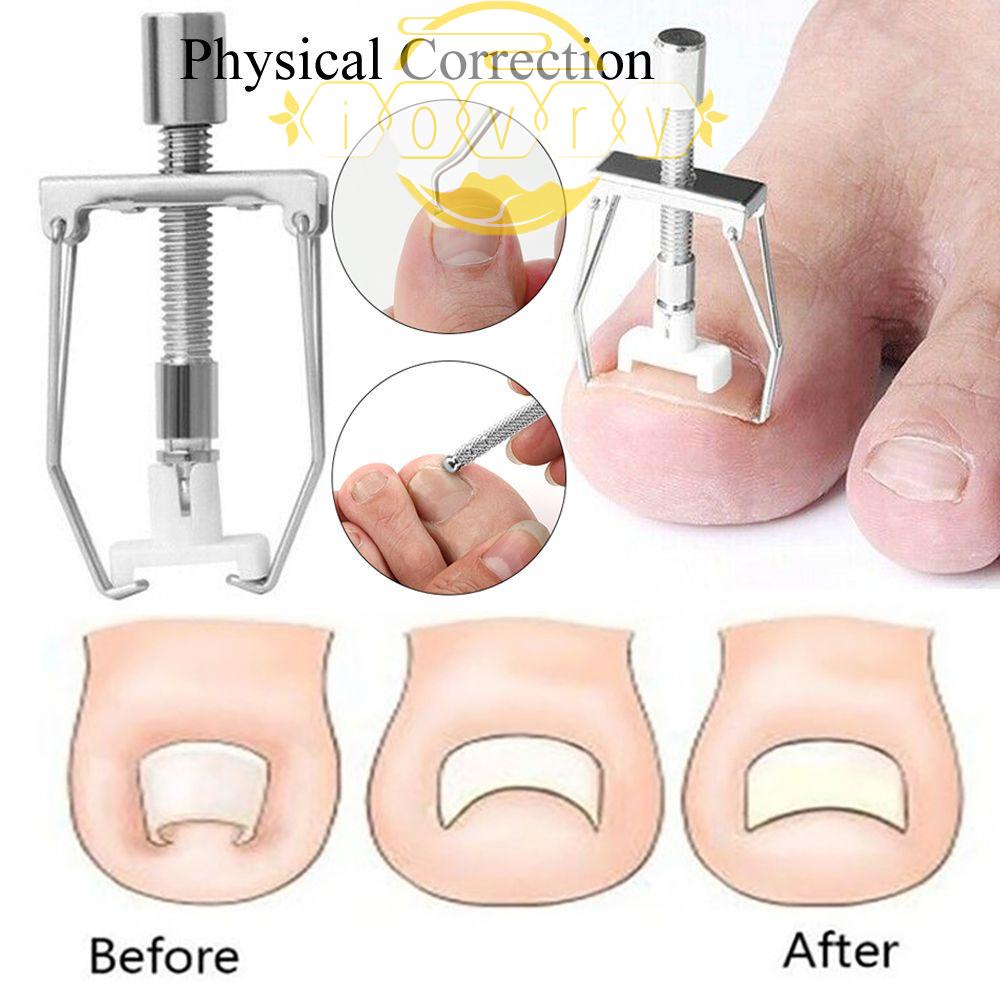 Dụng Cụ Chỉnh Hình Móng Chân Mọc Ngược Bằng Ngà Voi