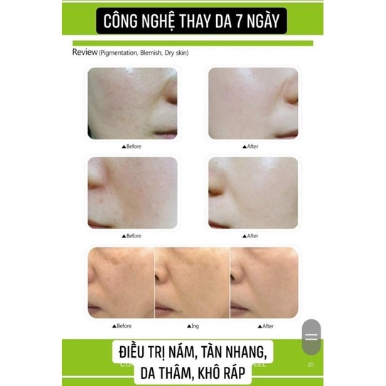 Peel Thảo Mộc Zellkur Krauter Peel