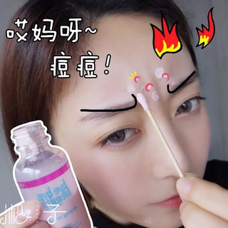 Lotion Chấm Mụn Bye-Bye Blemish For Acne