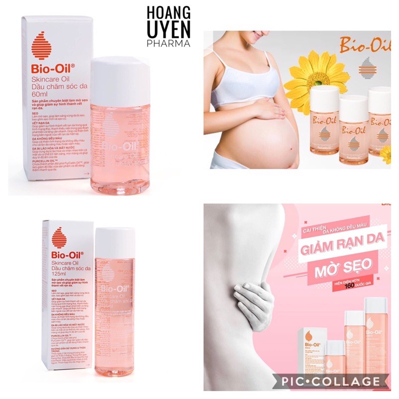 Tinh dầu Bio Oil dưỡng da, chống rạn da (Bio-oil)