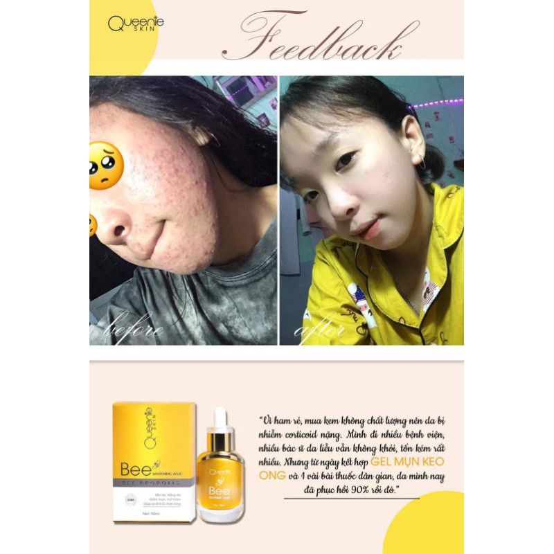 Gel Mụn Keo Ong 50ml 'BEE WHITENING ACNE' CÔNG TY DƯỢC MỸ PHẪM QUEENIE SKIN