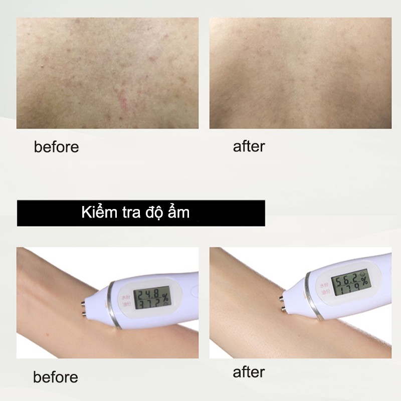 (Hàng Mới Về) RNW Gel Tắm Dưỡng Ẩm Làm Trắng Khử Mùi Lâu Trôi 400g