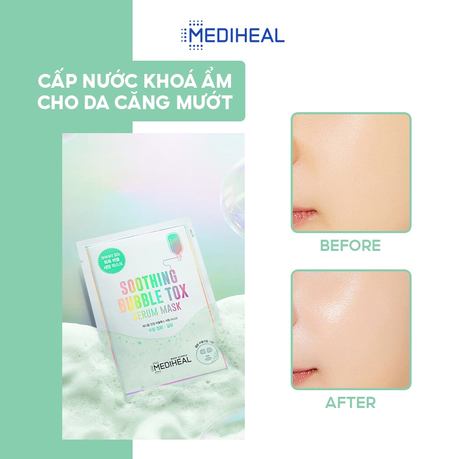 Mặt Nạ Sủi Bọt Thải Độc, Cấp Ẩm, Làm Dịu Da Mediheal Soothing Bubble Tox Serum Mask 25ml [K58]