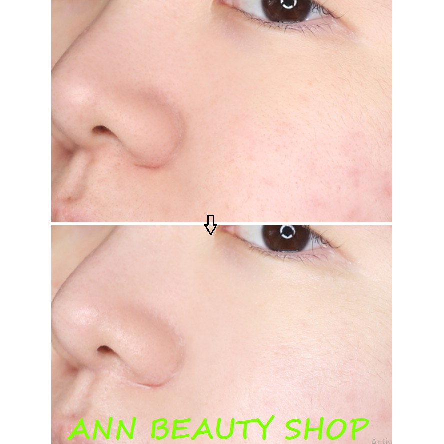 Kem dưỡng da mặt và toàn thân Illiyoon Ceramide Ato Concentrate Cream | BigBuy360 - bigbuy360.vn