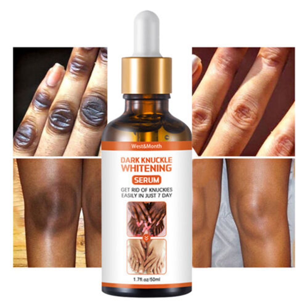 Serum Dưỡng Ẩm Làm Trắng Da Loại Bỏ Quầng Thâm Và Làm Sáng Da