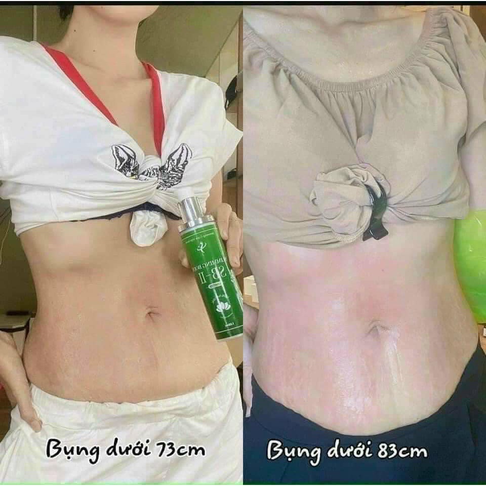 TINH DẦU HỦY MỠ SLIMMING BODY II  – THẨM THẤU NHANH, KHÔNG GÂY NÓNG BỎNG RÁT