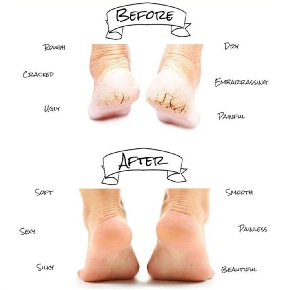 Vớ Gel Chăm Sóc Da Gót Chân Dưỡng Ẩm Mịn Màng Có Thể Tái Sử