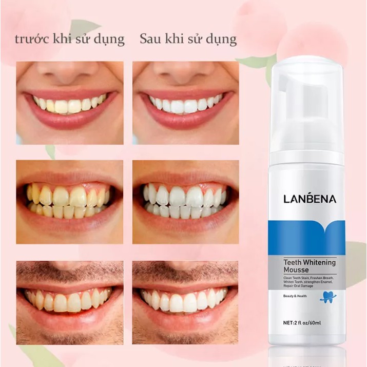 Trắng Răng Tinh Chất Bạc Hà Khử Mùi Hôi Miệng Làm Sạch Vết Ố 60ML LANBENA