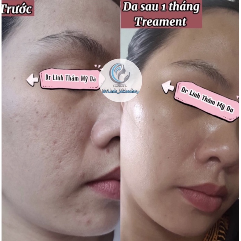 Kem dưỡng trắng da chống lão chuyên sâu 1% Retinol Paula’s Choice TM06