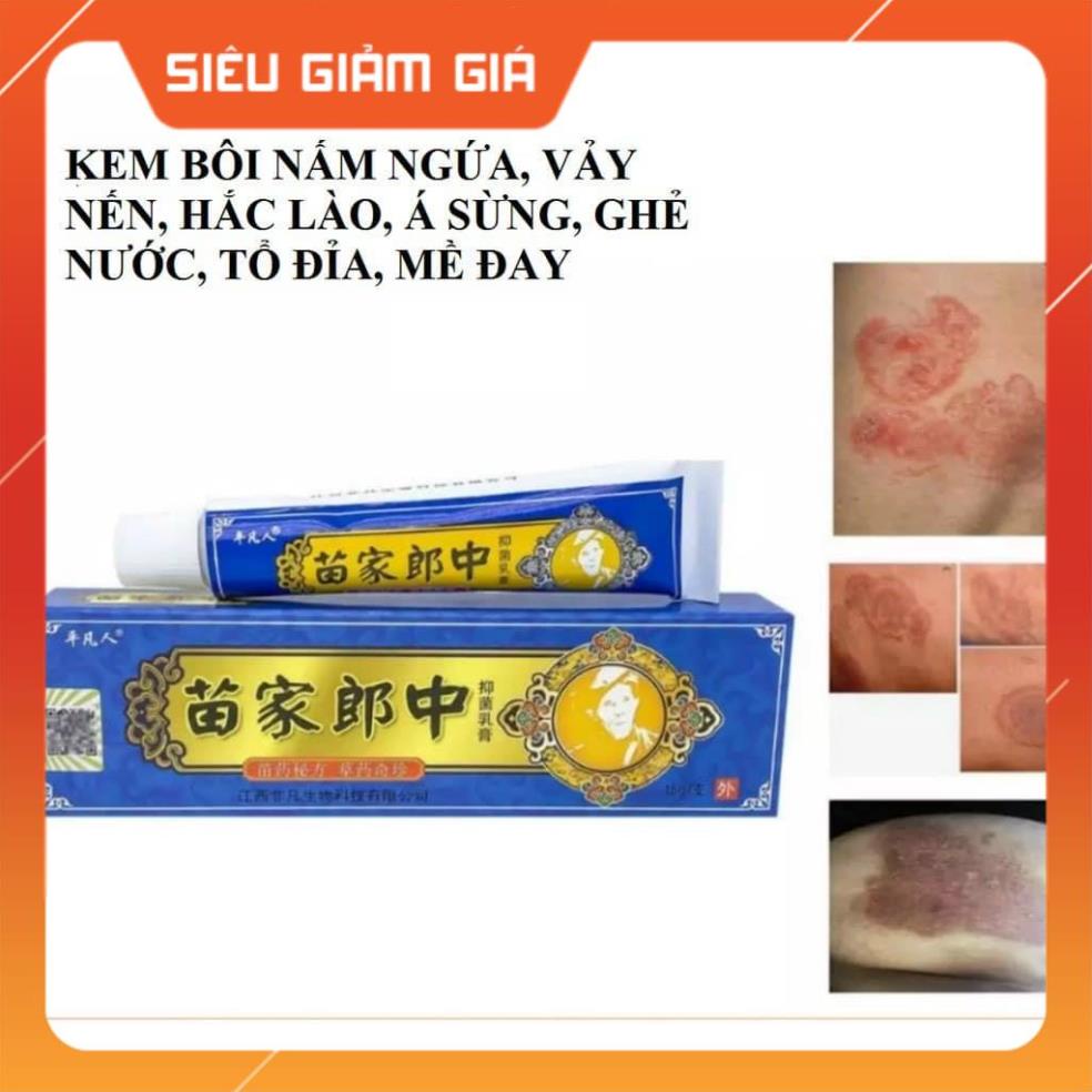 Kem đông y bôi ngứa, nấm, hắc lào, vẩy nến,...(XANH DƯƠNG)