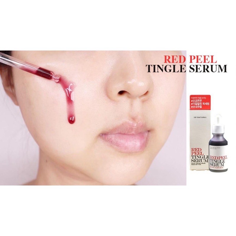 Tinh Chất Red Peel Tingle Serum So Natural | BigBuy360 - bigbuy360.vn