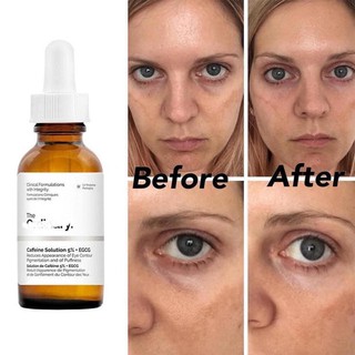 Serum phòng thâm bọng mắt The Ordinary Caffeine solution 5%