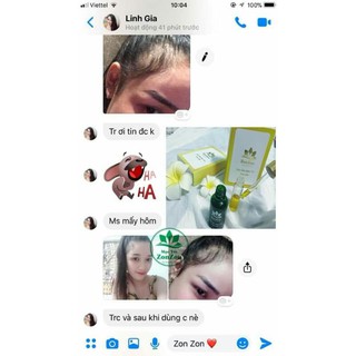 TINH DẦU MỌC TÓC CAO CẤP ZON ZON