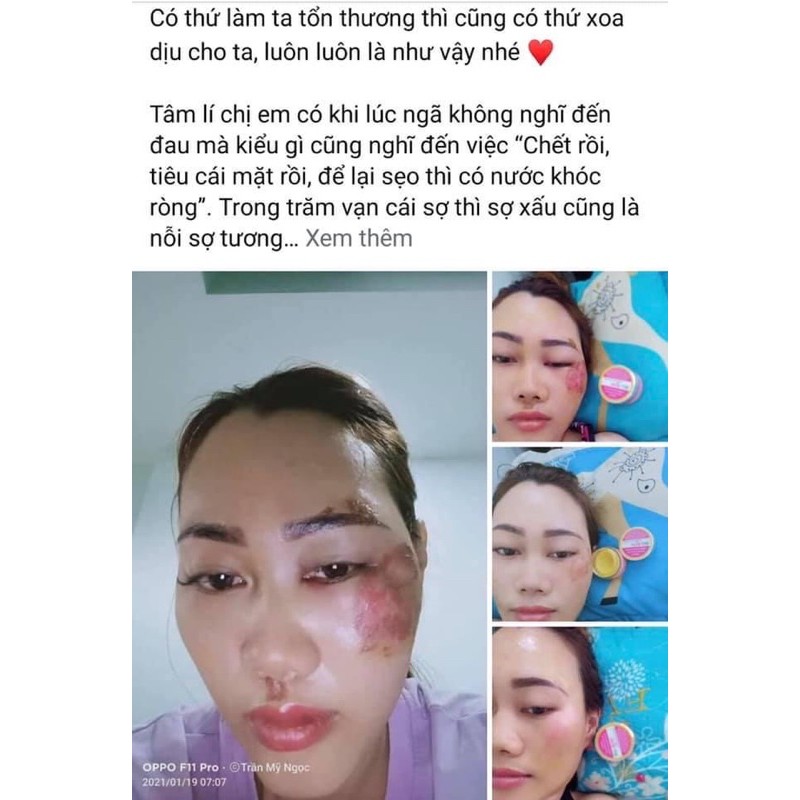 Kem Nghệ Đa Năng Mul-Rose - Chính Hãng 100%