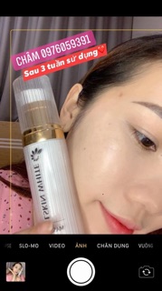 ủ kén tằm nuôi da